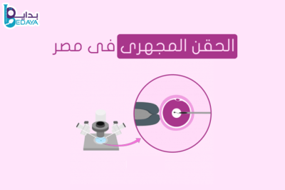 الحقن المجهري فى مصر