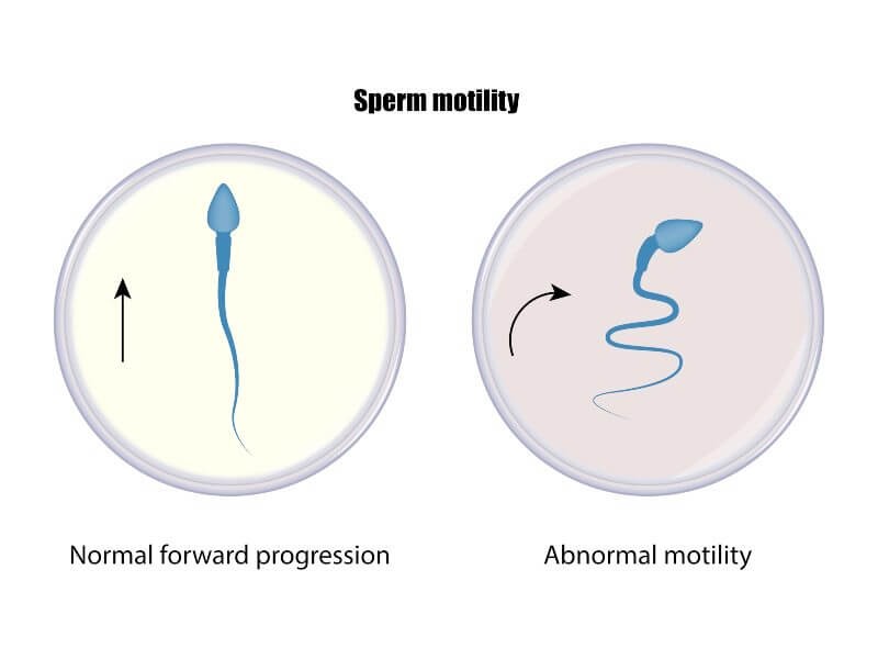 normal range and abnormal range of sperm motility