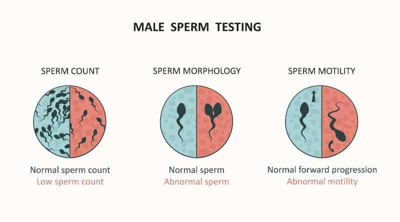 How to read a sperm analysis report 