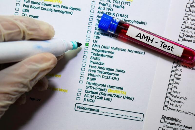 تحليل مخزن المبيض AMH