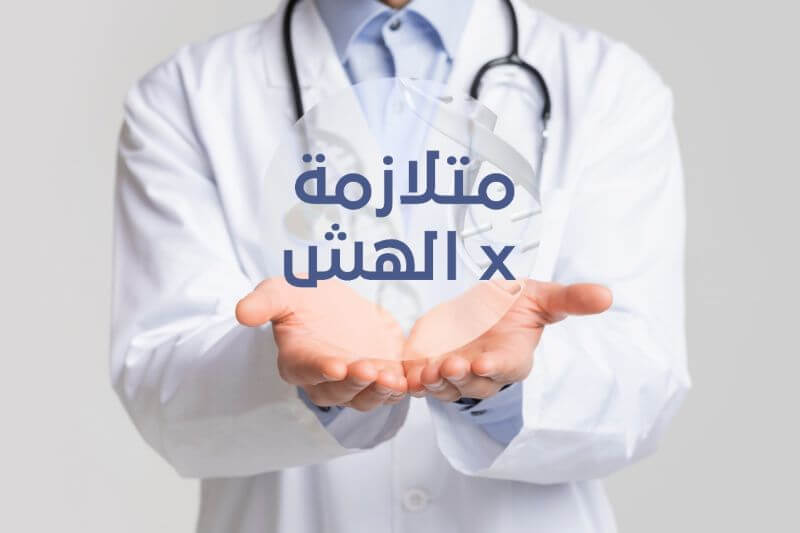 متلازمة X الهش