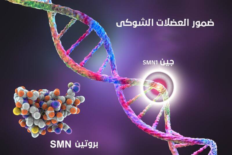 ضمور العضلات الشوكي