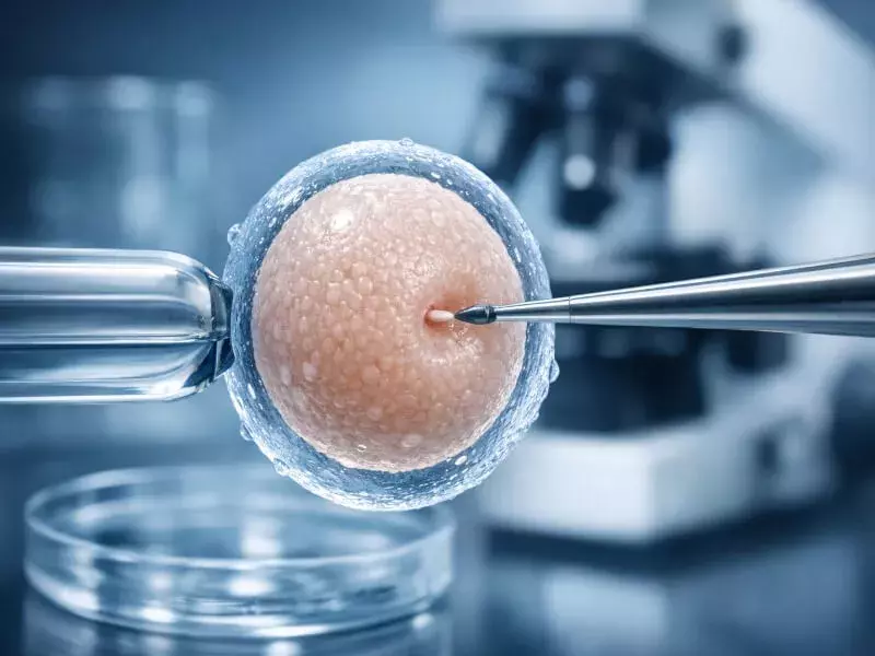 الحقن المجهري