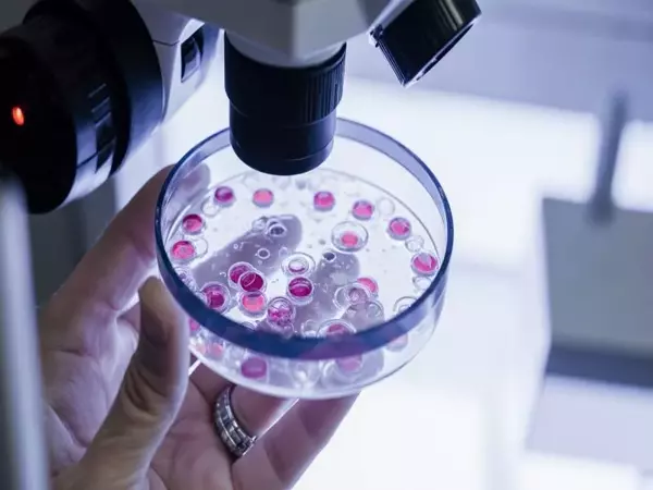 إنضاج البويضات في المختبر (IVM)